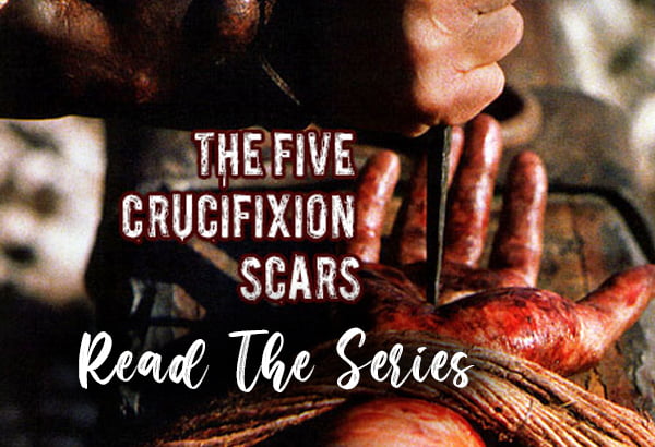 The Five Crucifixion Scars – The First Scar